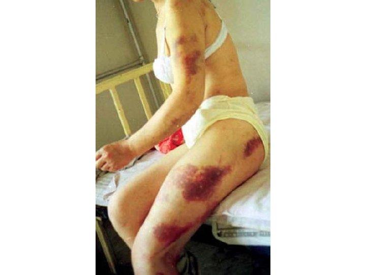 Per Isdal - Alternativ til Vold 