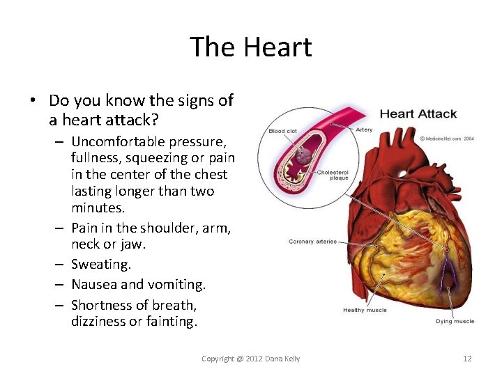 The Heart • Do you know the signs of a heart attack? – Uncomfortable