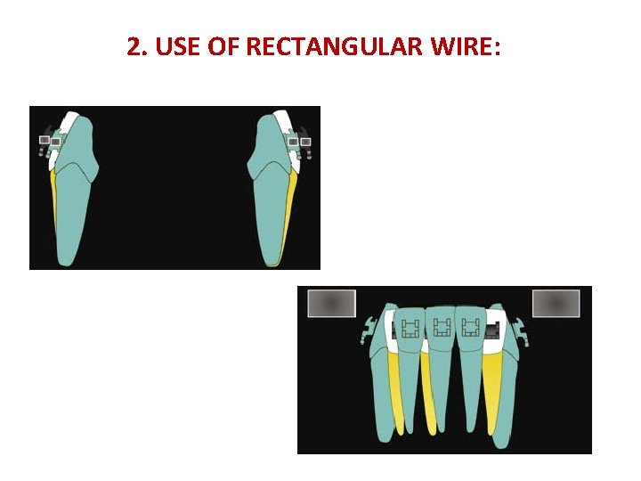 2. USE OF RECTANGULAR WIRE: 