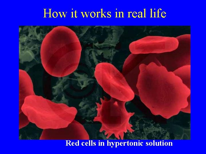 How it works in real life Red cells in hypertonic solution 