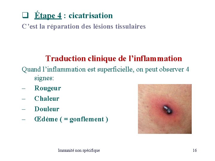 q Étape 4 : cicatrisation C’est la réparation des lésions tissulaires Traduction clinique de q Étape 4 : cicatrisation C’est la réparation des lésions tissulaires Traduction clinique de