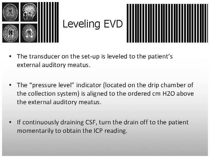 Leveling EVD • The transducer on the set-up is leveled to the patient’s external