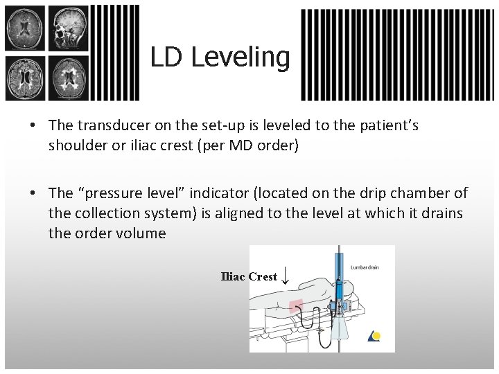 LD Leveling • The transducer on the set-up is leveled to the patient’s shoulder