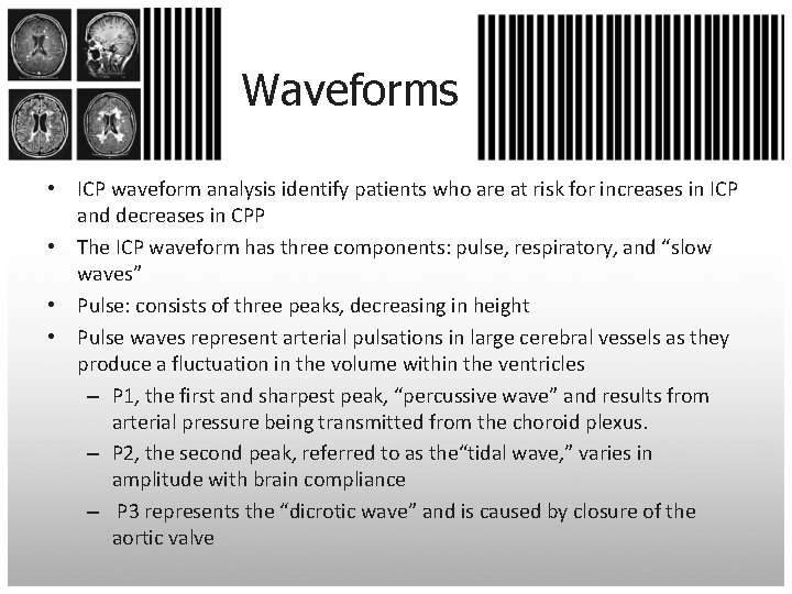 Waveforms • ICP waveform analysis identify patients who are at risk for increases in