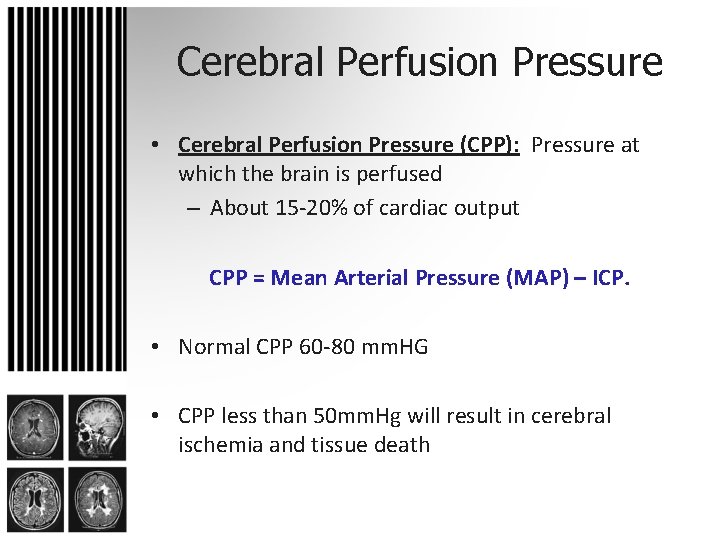 Cerebral Perfusion Pressure • Cerebral Perfusion Pressure (CPP): Pressure at which the brain is