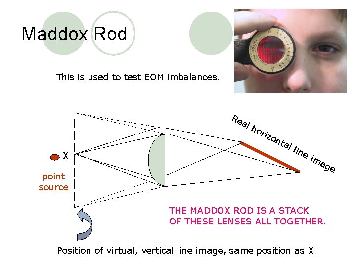 Maddox Rod This is used to test EOM imbalances. Re a X lh ori