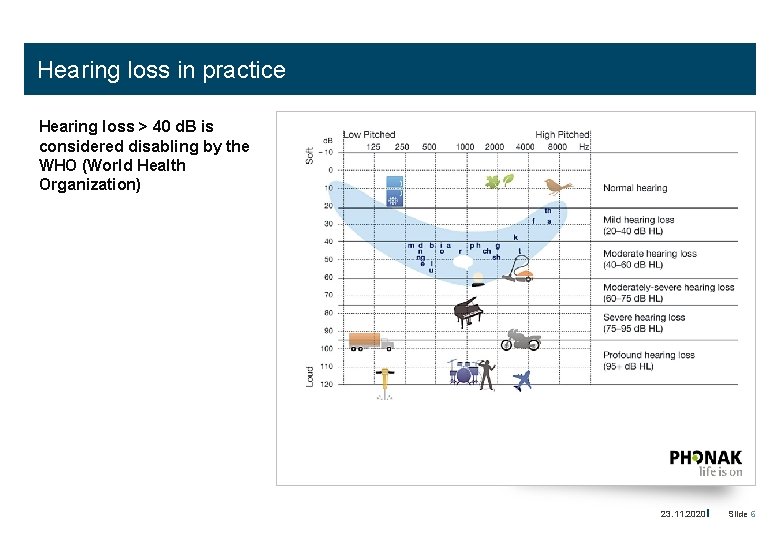 Hearing loss in practice Hearing loss > 40 d. B is considered disabling by