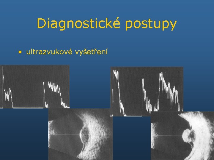 Diagnostické postupy • ultrazvukové vyšetření 