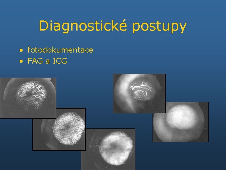 Diagnostické postupy • fotodokumentace • FAG a ICG 