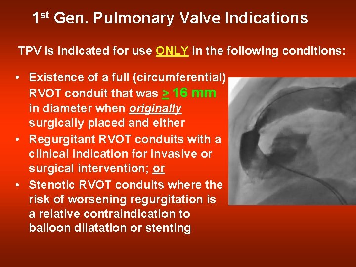 1 st Gen. Pulmonary Valve Indications TPV is indicated for use ONLY in the