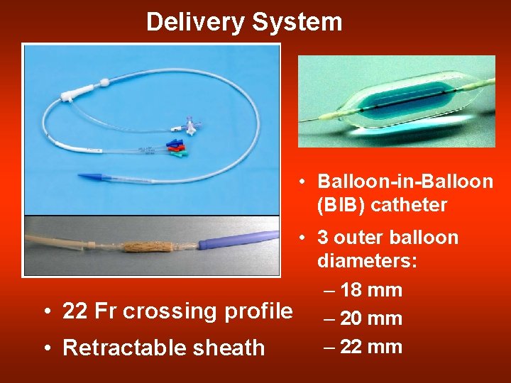 Delivery System • Balloon-in-Balloon (BIB) catheter • 3 outer balloon diameters: – 18 mm