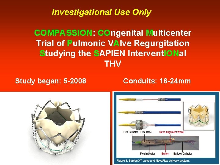 Investigational Use Only COMPASSION: COngenital Multicenter Trial of Pulmonic VAlve Regurgitation Studying the SAPIEN