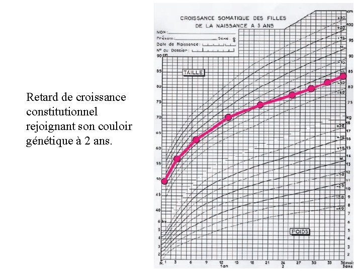 Retard de croissance constitutionnel rejoignant son couloir génétique à 2 ans. 
