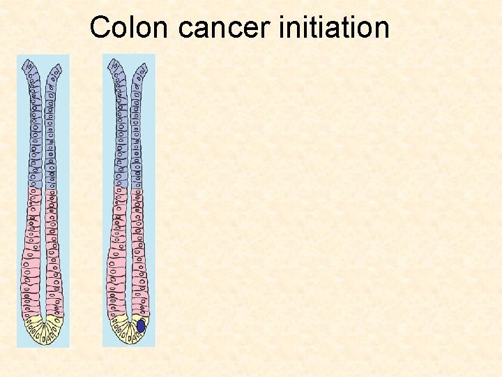 Colon cancer initiation 