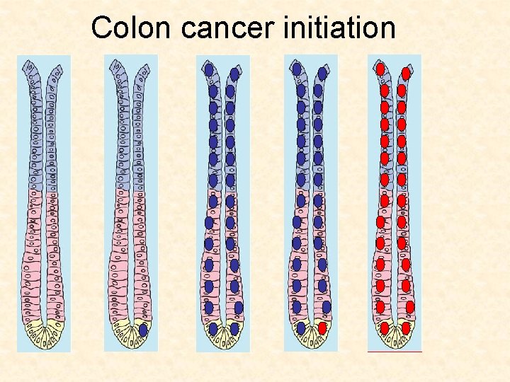 Colon cancer initiation 