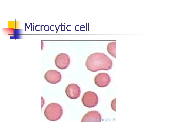 Microcytic cell Microcytic cell