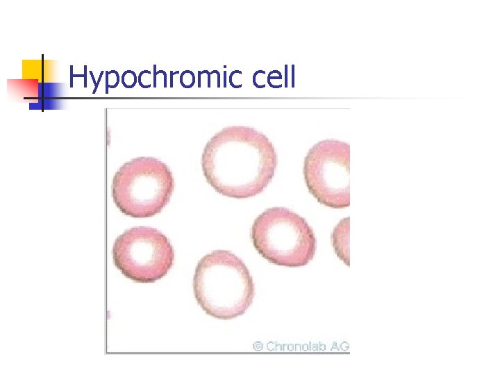 Hypochromic cell 