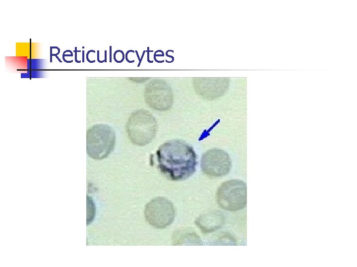 Reticulocytes 