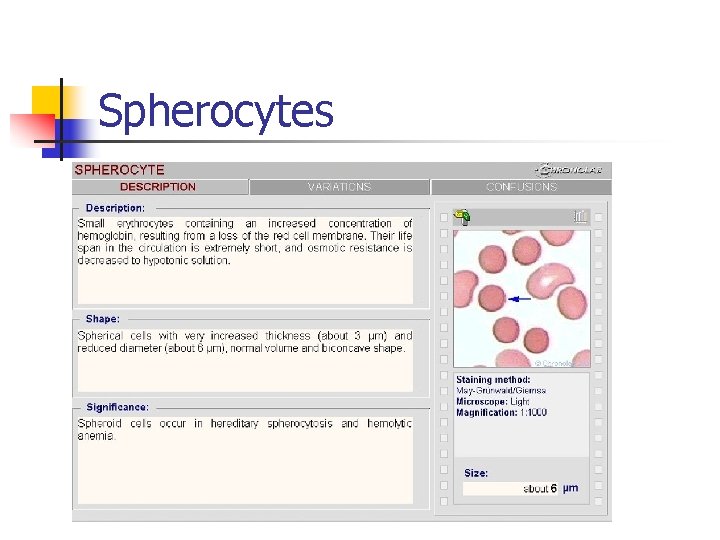 Spherocytes 