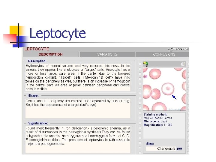 Leptocyte 