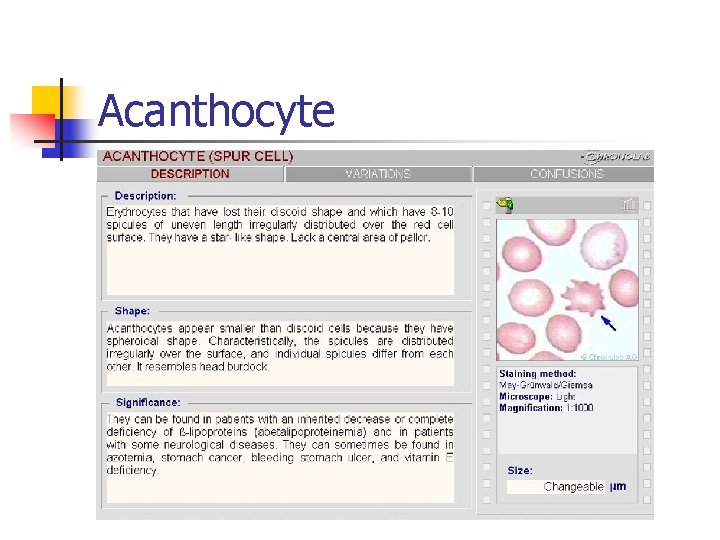 Acanthocyte 