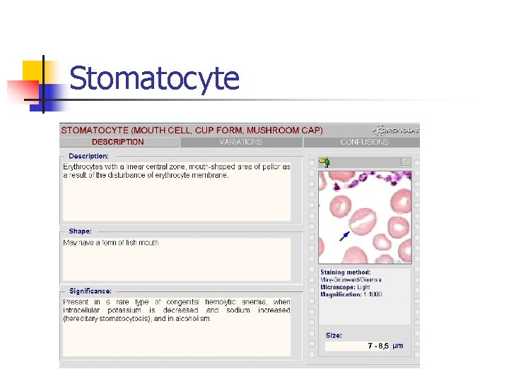 Stomatocyte 
