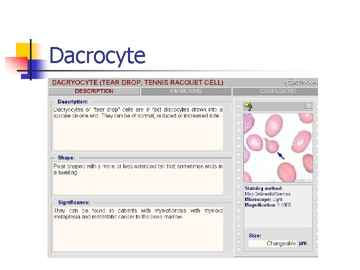 Dacrocyte Dacrocyte