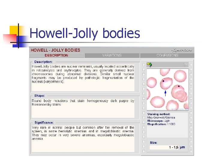 Howell-Jolly bodies 
