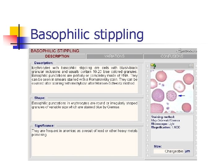 Basophilic stippling 