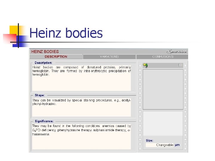 Heinz bodies 