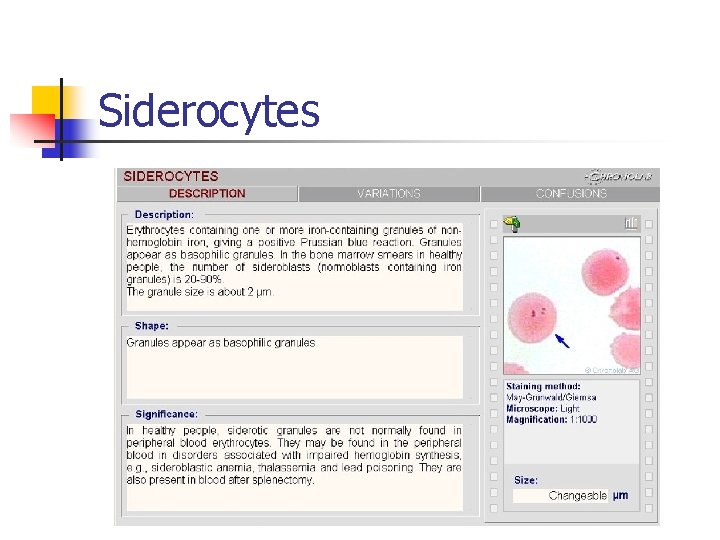 Siderocytes 