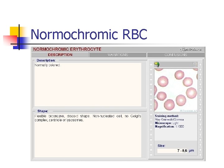 Normochromic RBC 