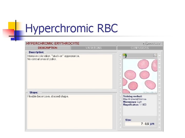 Hyperchromic RBC 