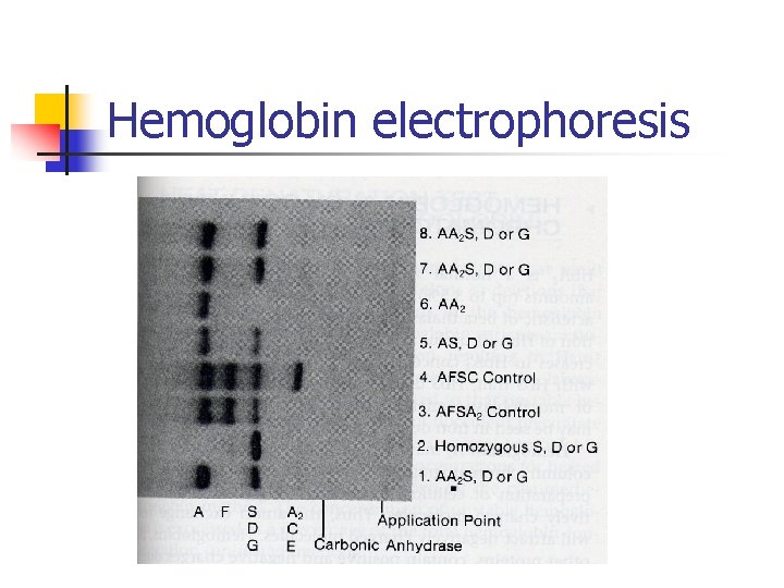 Hemoglobin electrophoresis 