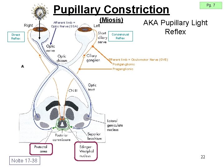 Pg. 7 Pupillary Constriction Right Direct Reflex Afferent limb = Optic Nerve (SSA) (Miosis) Pg. 7 Pupillary Constriction Right Direct Reflex Afferent limb = Optic Nerve (SSA) (Miosis)