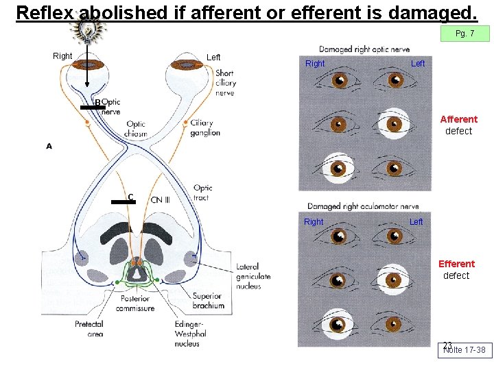 Reflex abolished if afferent or efferent is damaged. Pg. 7 Right Left B Afferent Reflex abolished if afferent or efferent is damaged. Pg. 7 Right Left B Afferent