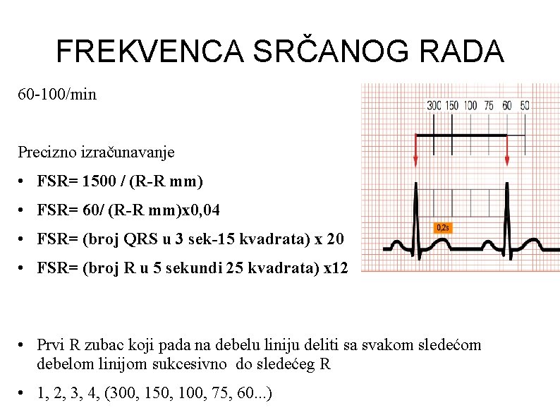 FREKVENCA SRČANOG RADA 60 -100/min Precizno izračunavanje • FSR= 1500 / (R-R mm) • FREKVENCA SRČANOG RADA 60 -100/min Precizno izračunavanje • FSR= 1500 / (R-R mm) •
