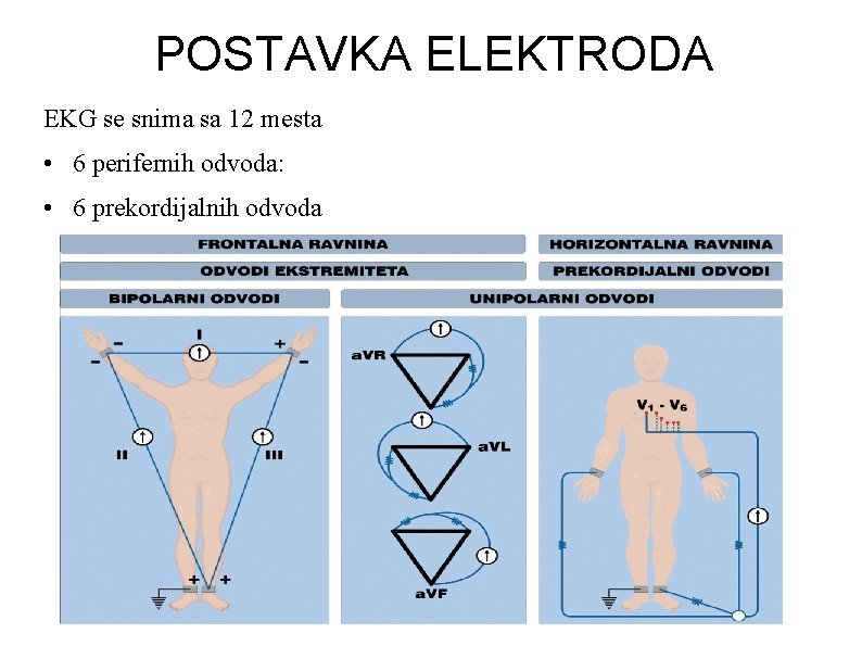 POSTAVKA ELEKTRODA EKG se snima sa 12 mesta • 6 perifernih odvoda: • 6 POSTAVKA ELEKTRODA EKG se snima sa 12 mesta • 6 perifernih odvoda: • 6