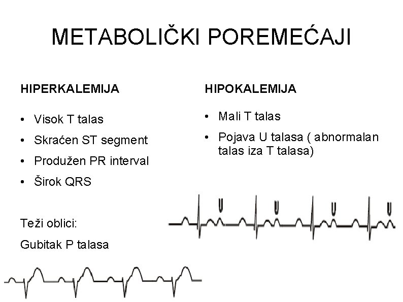 METABOLIČKI POREMEĆAJI HIPERKALEMIJA HIPOKALEMIJA • Visok T talas • Mali T talas • Skraćen