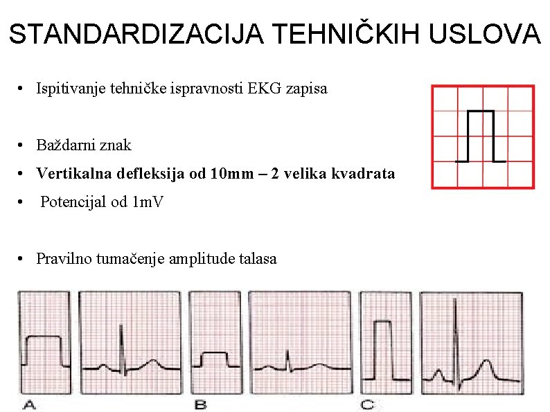 STANDARDIZACIJA TEHNIČKIH USLOVA • Ispitivanje tehničke ispravnosti EKG zapisa • Baždarni znak • Vertikalna