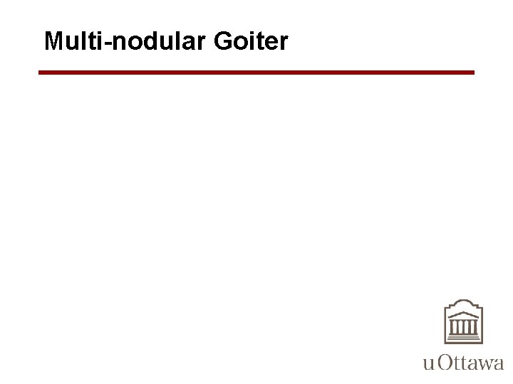 Multi-nodular Goiter 