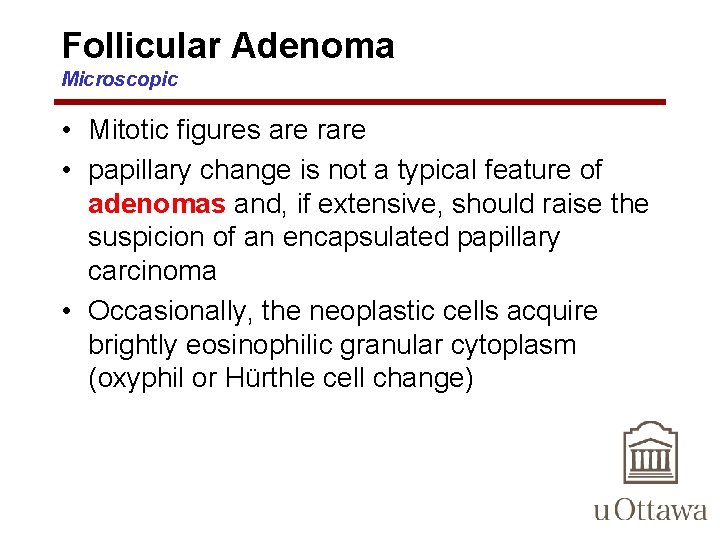 Follicular Adenoma Microscopic • Mitotic figures are rare • papillary change is not a