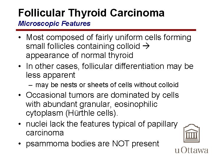 Follicular Thyroid Carcinoma Microscopic Features • Most composed of fairly uniform cells forming small