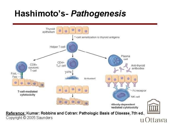 Hashimoto’s- Pathogenesis Reference: Kumar: Robbins and Cotran: Pathologic Basis of Disease, 7 th ed.