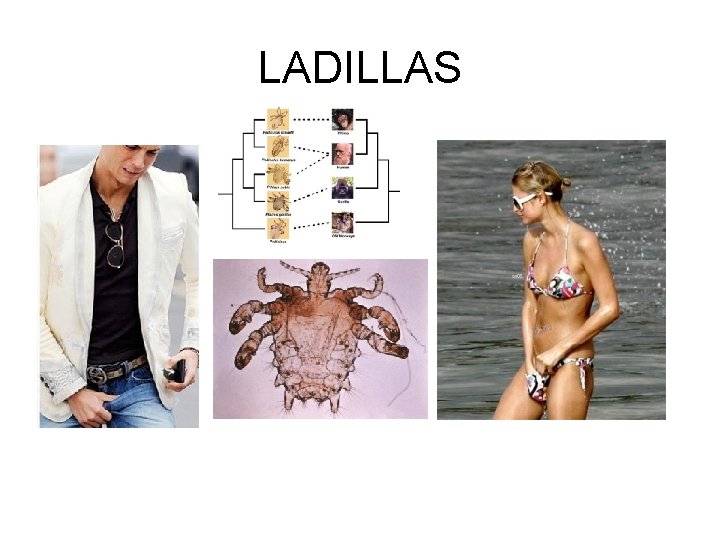 LADILLAS 