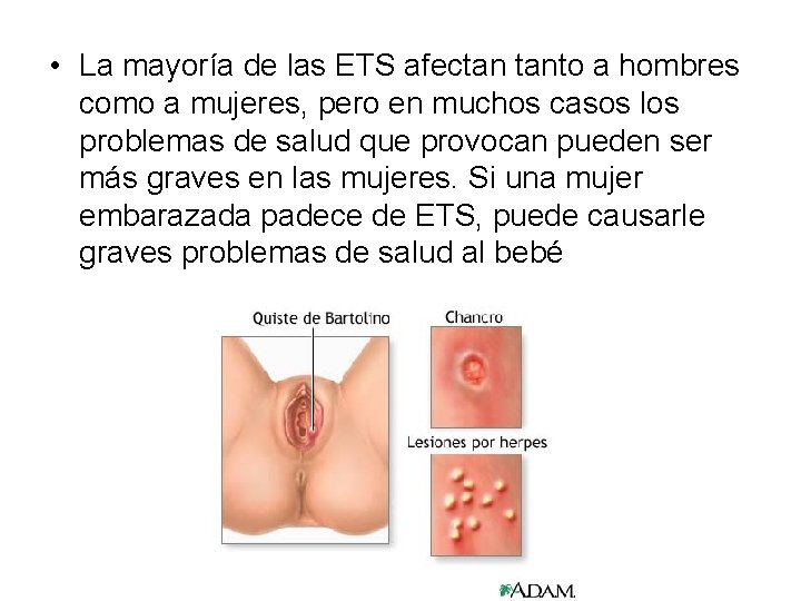  • La mayoría de las ETS afectan tanto a hombres como a mujeres,