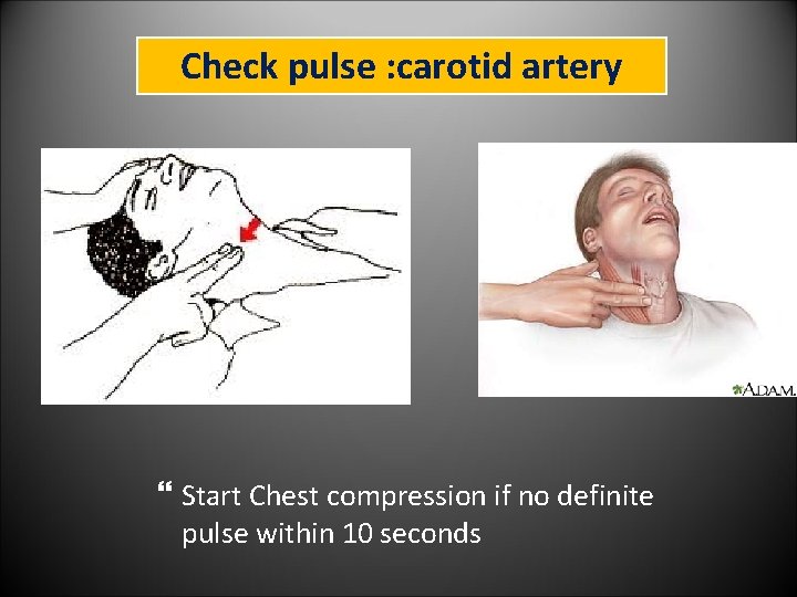 Check pulse : carotid artery Start Chest compression if no definite pulse within 10