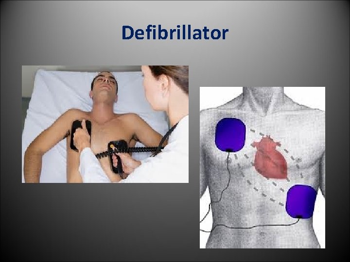 Defibrillator 