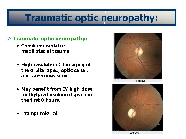 Traumatic optic neuropathy: • Consider cranial or maxillofacial trauma • High resolution CT imaging
