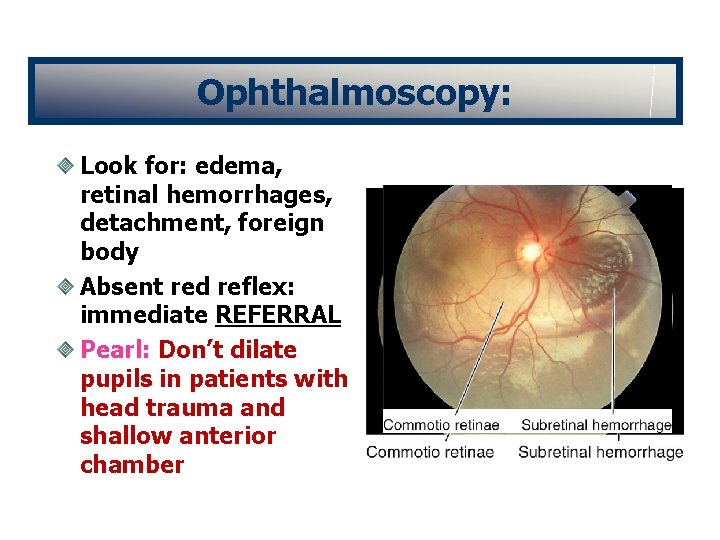 Ophthalmoscopy: Look for: edema, retinal hemorrhages, detachment, foreign body Absent red reflex: immediate REFERRAL